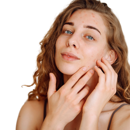 Risultati trattamento detox viso - pelle purificata e opacizzata