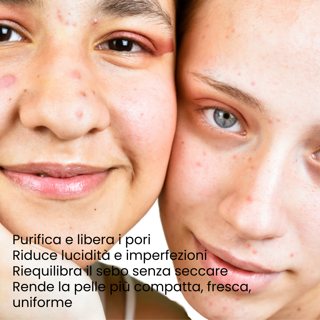 Pelle purificata e detox - risultati siero purificante pelli impure